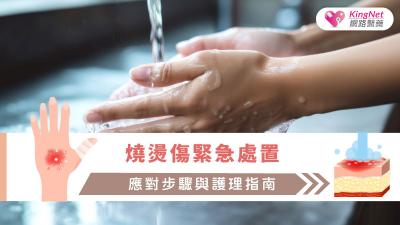 燒燙傷緊急處置：應對步驟與護理指南