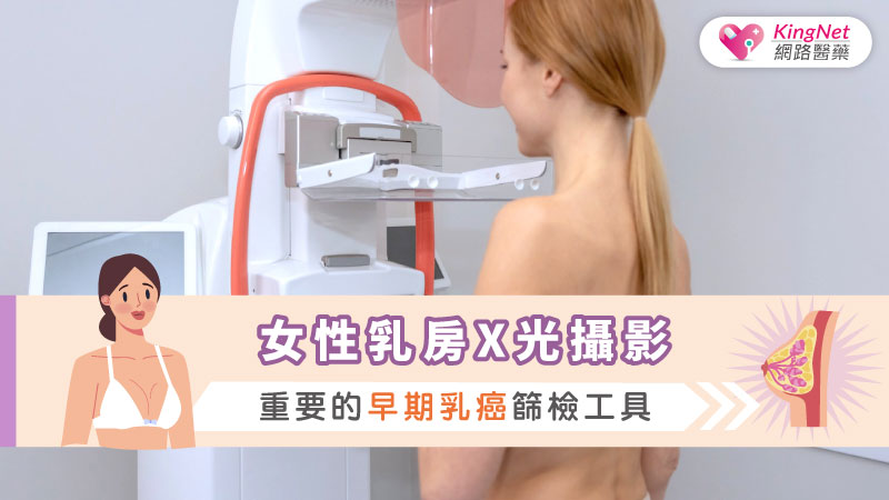女性乳房X光攝影：重要的早期乳癌篩檢工具