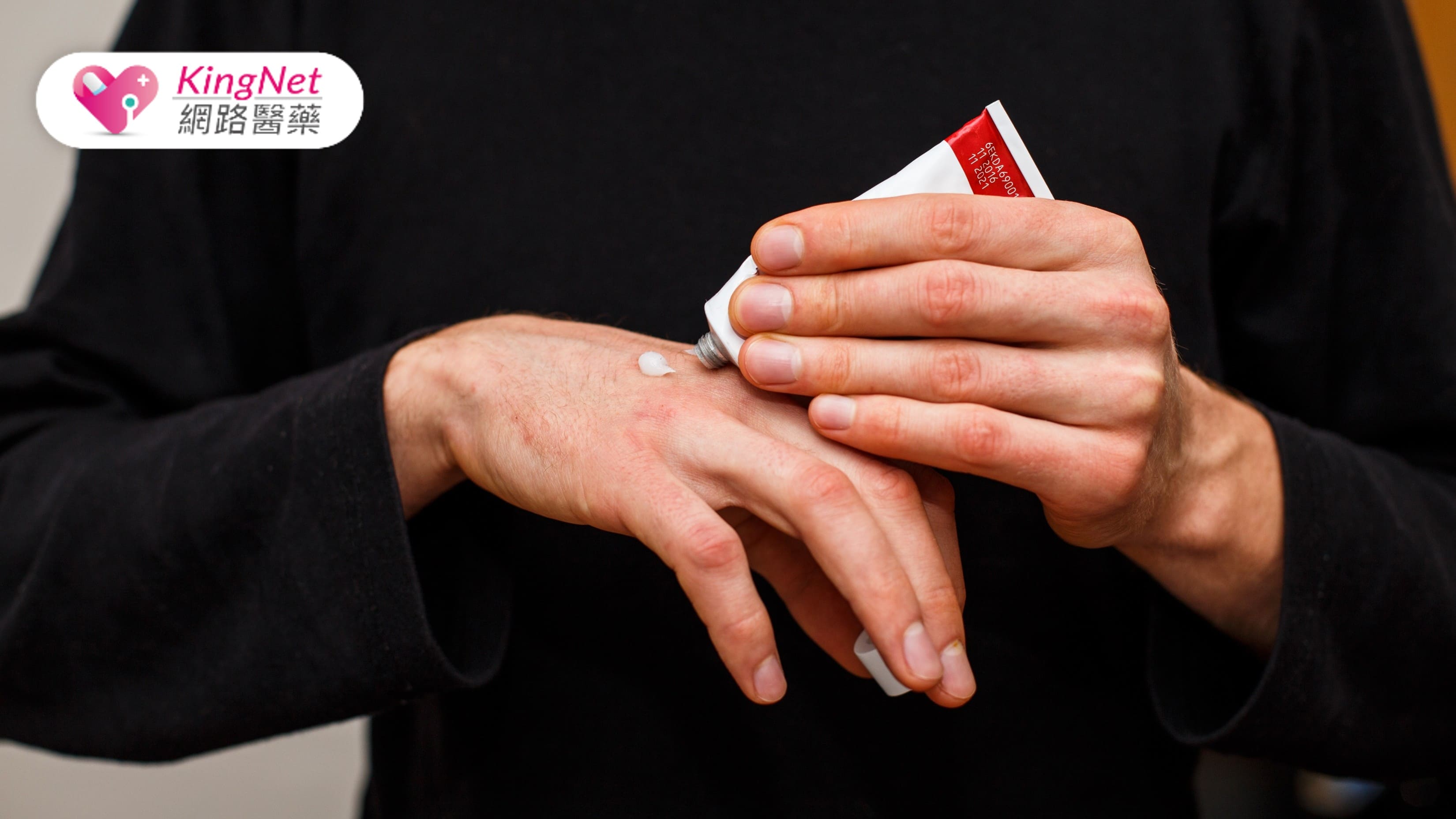 換季皮膚乾裂別亂擦藥！擦錯藥手掌潰爛　醫警告這3種錯誤最常見_圖1