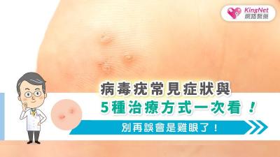 病毒疣常見症狀與5種治療方式一次看！別再誤會是雞眼了！