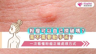 粉瘤可以自己擠破嗎？需不需要動手術？一次看懂粉瘤正確處理方式
