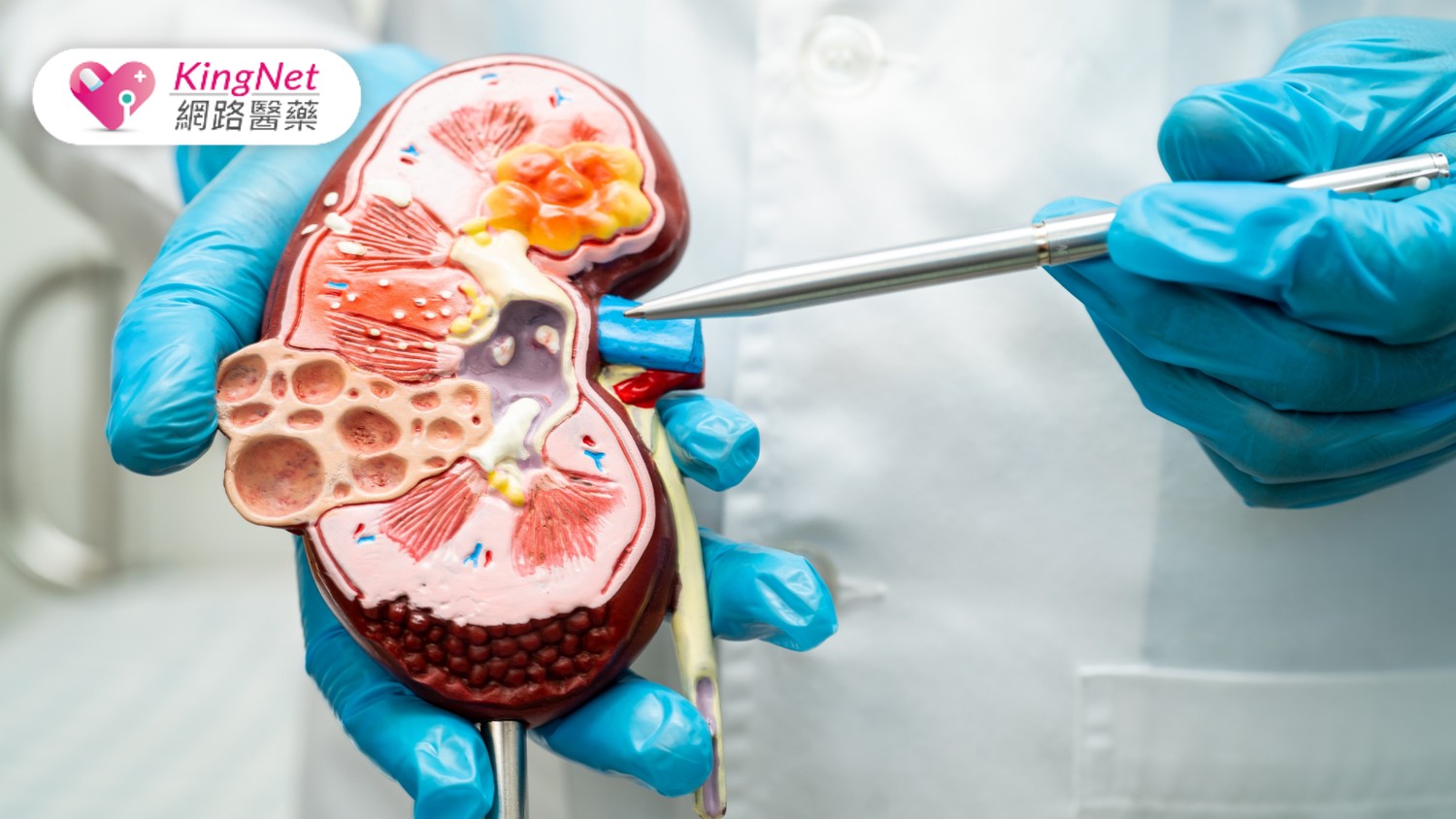  血型不合也能換腎！47歲媽擊敗FSGS　弟弟捐腎助她重生_圖1