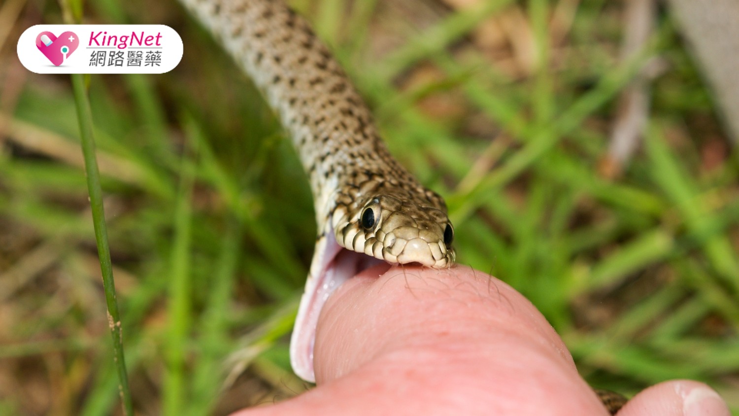 誤信偏方恐致命！醫師教你毒蛇咬傷正確處理法_圖1