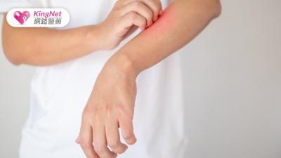 夏天皮膚病大爆發！醫師教你怎麼預防4大常見的皮膚問題