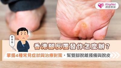 香港腳反覆發作怎麼辦？掌握4種常見症狀與治療對策，幫雙腳脫離搔癢與脫皮