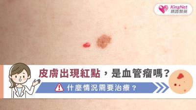皮膚出現紅點，是血管瘤嗎？什麼情況需要治療？