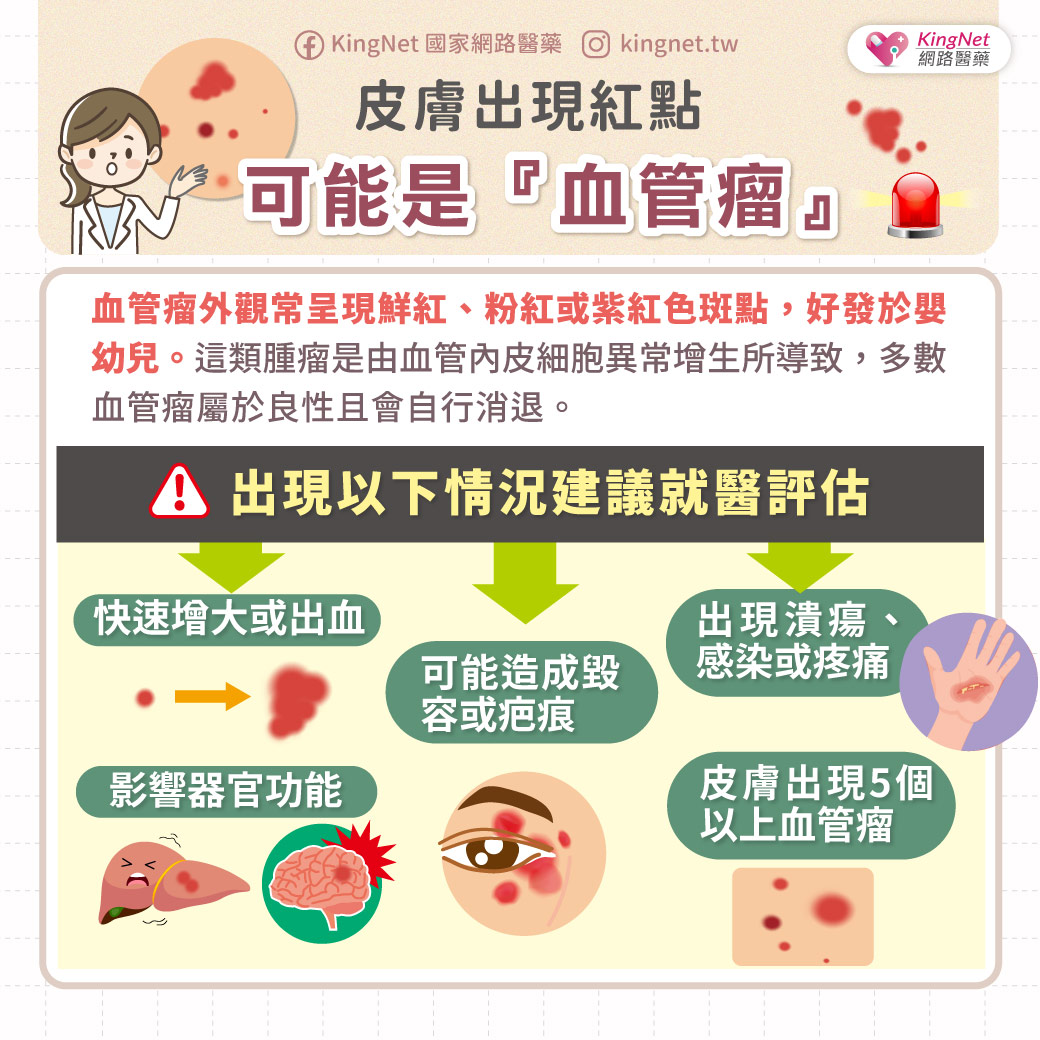 血管瘤出現這些症狀建議就醫檢查