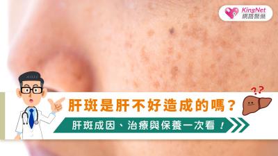 肝斑是肝不好造成的嗎？肝斑成因、治療與保養一次看！