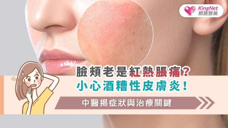 臉頰老是紅熱脹痛？小心酒糟性皮膚炎！中醫揭症狀與治療關鍵_圖1