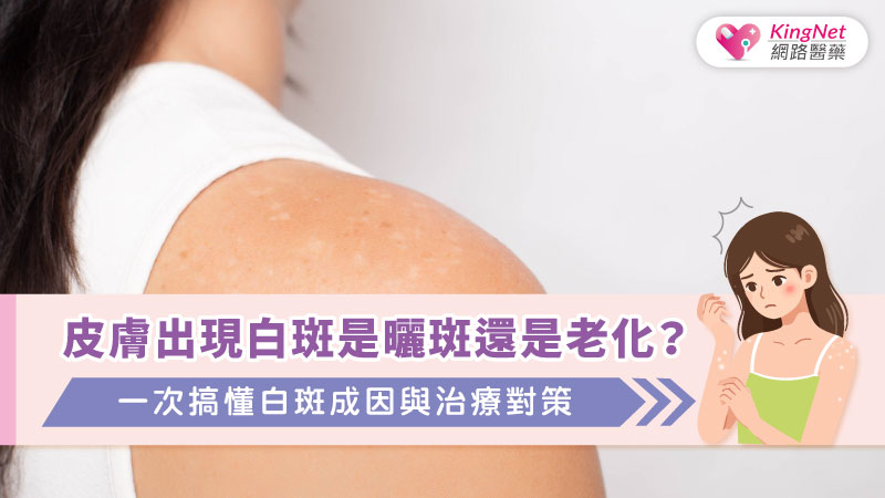 皮膚出現白斑是曬斑還是老化？一次搞懂白斑成因與治療對策_圖1