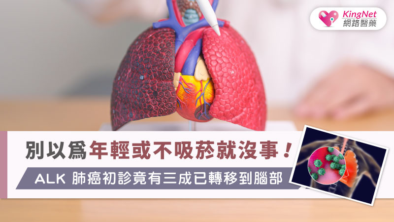 別以為年輕或不吸菸就沒事！ALK肺癌初診竟有三成已轉移到腦部 _圖1