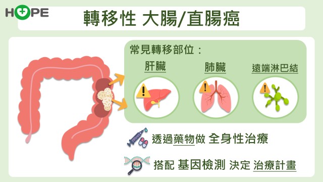 轉移性大腸癌根治新攻略：醫師解析一線至四線用藥選擇_圖2