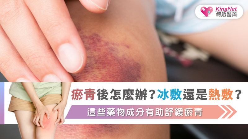 瘀青後怎麼辦？冰敷還是熱敷？這些藥物成分有助舒緩瘀青