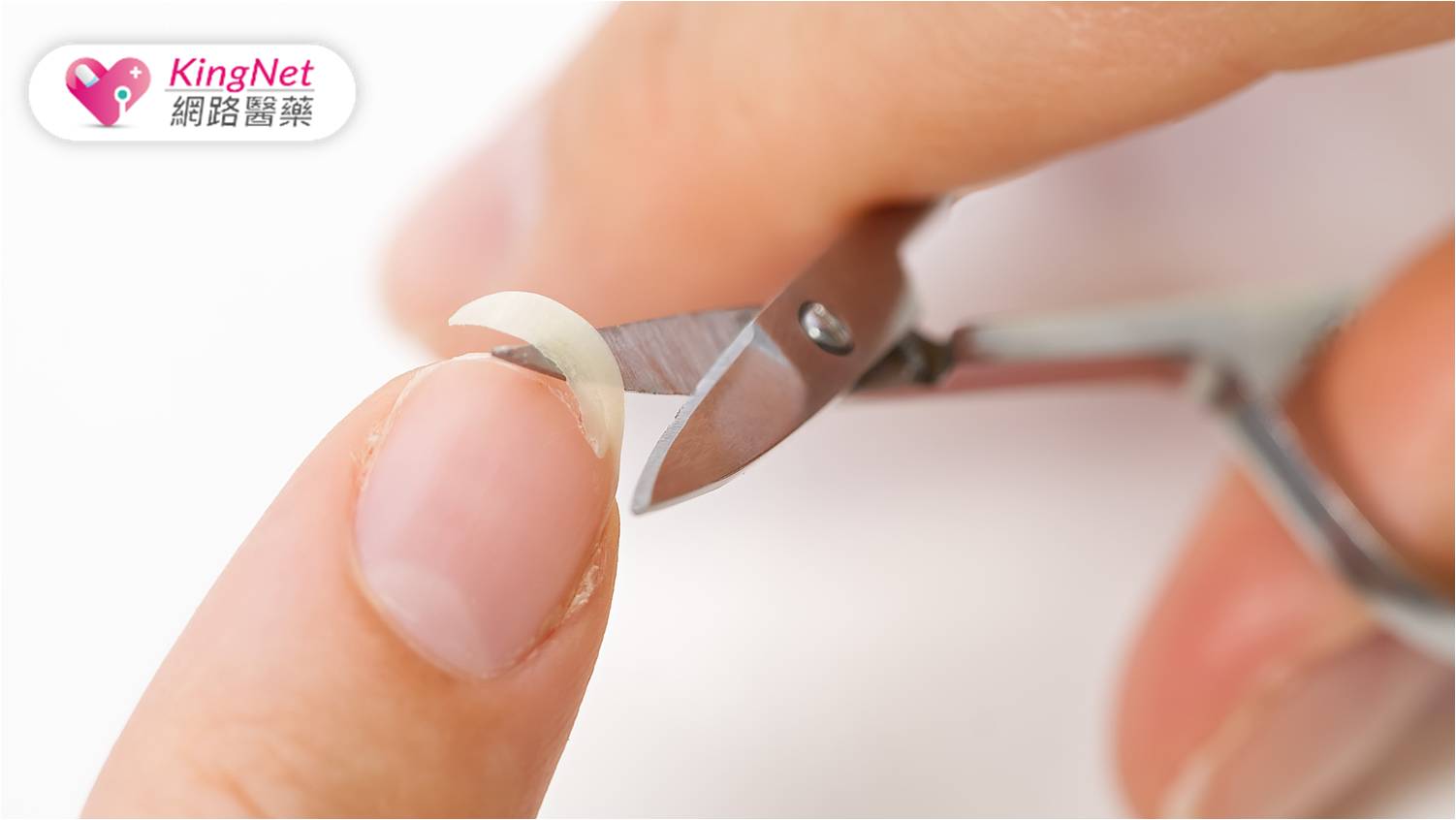 剪指甲1錯誤習慣讓她「甲溝炎」爆痛流血！　如何剪指甲才正確？_圖1