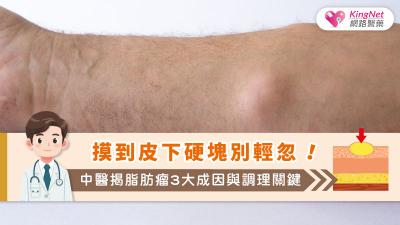 摸到皮下硬塊別輕忽！中醫揭脂肪瘤3大成因與調理關鍵