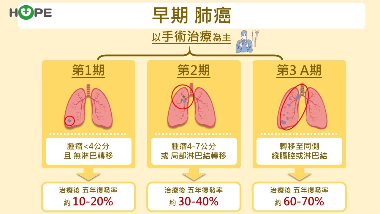 對於無基因突變的早期肺癌　圍手術期治療可有效減少術後復發風險_圖2