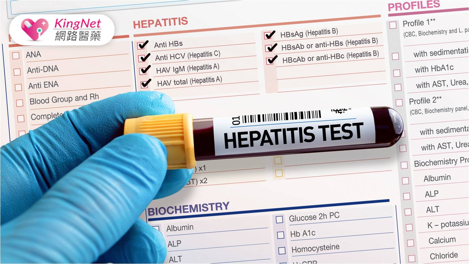 B肝、C肝免費篩檢擴大！　診斷B、C型肝炎需做哪些檢驗？報告結果怎麼看？