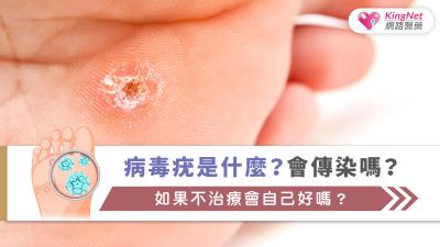 病毒疣具有高度傳染性，雖多為良性，但及早發現與適當處理，並做好預防措施，是避免擴散與影響生活的關鍵。