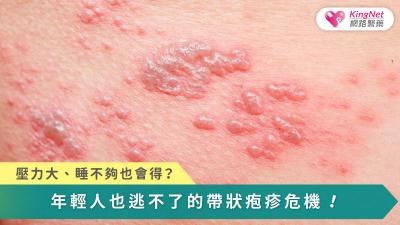 帶狀疱疹源自免疫力下降，無論年齡都可能發作；及早治療、調理體質並維持良好生活習慣，才能降低急性疼痛與長期神經痛的風險。