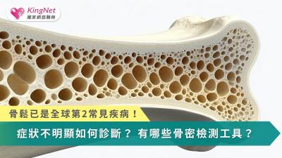 骨鬆已是全球第2常見疾病！　症狀不明顯如何診斷？有哪些骨密檢測工具？