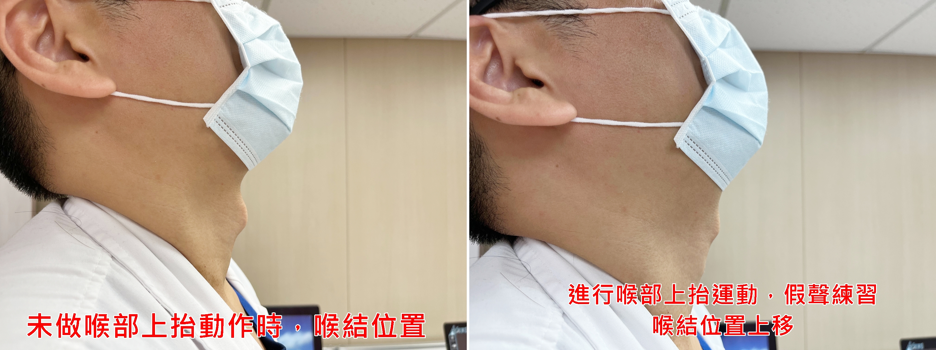 「喉部上抬運動」假聲練習時，可輕觸摸喉結感受喉部狀態（圖／衛福部臺北醫院提供）