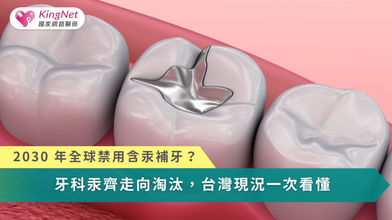 牙科汞齊的退場，不只是補牙材料的更替，而是公共衛生、環境責任與醫療公平之間的全球抉擇。
