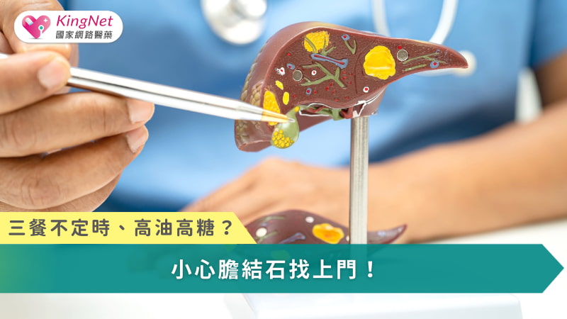 三餐不定時、高油高糖？小心膽結石找上門_圖1