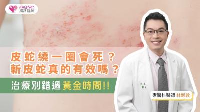 【影】帶狀皰疹年輕化　治療把握黃金時間！皮蛇繞一圈會死？斬皮蛇真的有效？