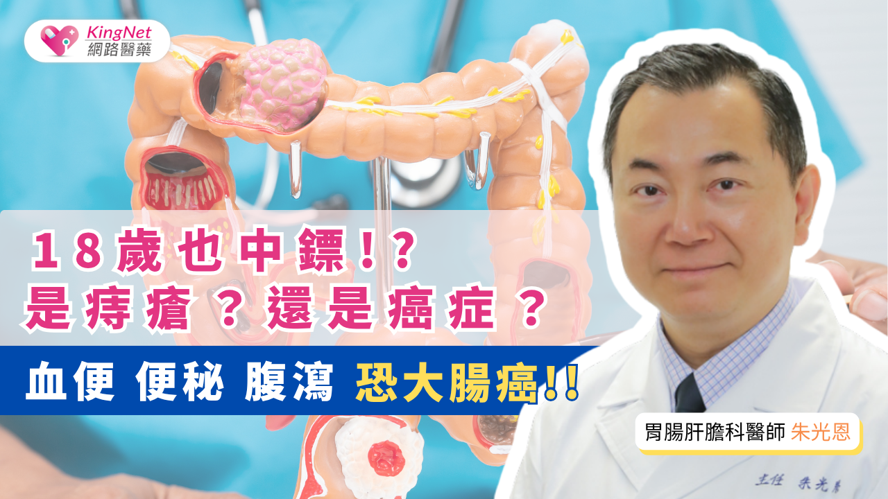 【影】18歲也中鏢？！醫師分析大腸癌年輕化原因　不明血便、便秘可能是警訊_圖1