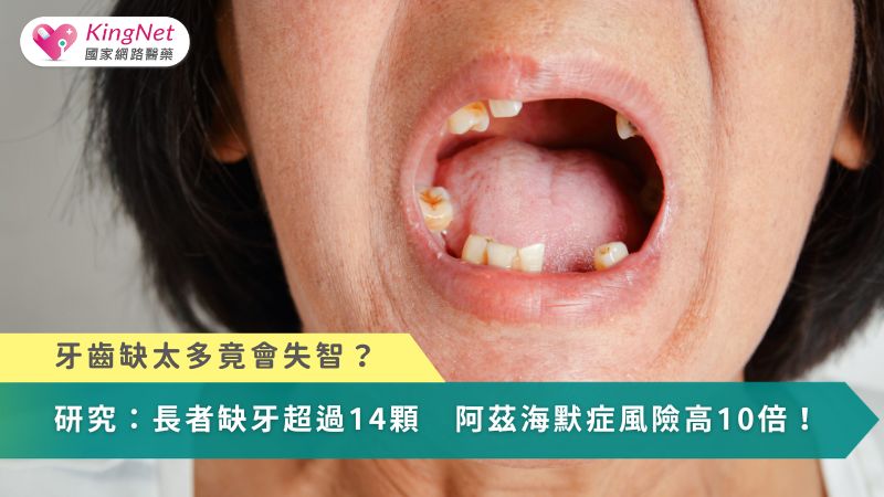 牙齒缺太多竟會失智？研究：長者缺牙超過14顆　阿茲海默症風險高10倍！_圖1