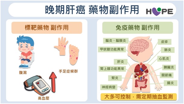 晚期肝癌不等於沒救！醫分享真實案例　「微創＋免疫」讓10cm腫瘤完全消失_圖9