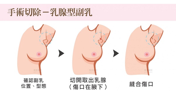 陳心瑜醫師|整形外科|我的文章|個人主頁|KingNet國家網路醫藥