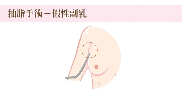 陳心瑜醫師|整形外科|我的文章|個人主頁|KingNet國家網路醫藥