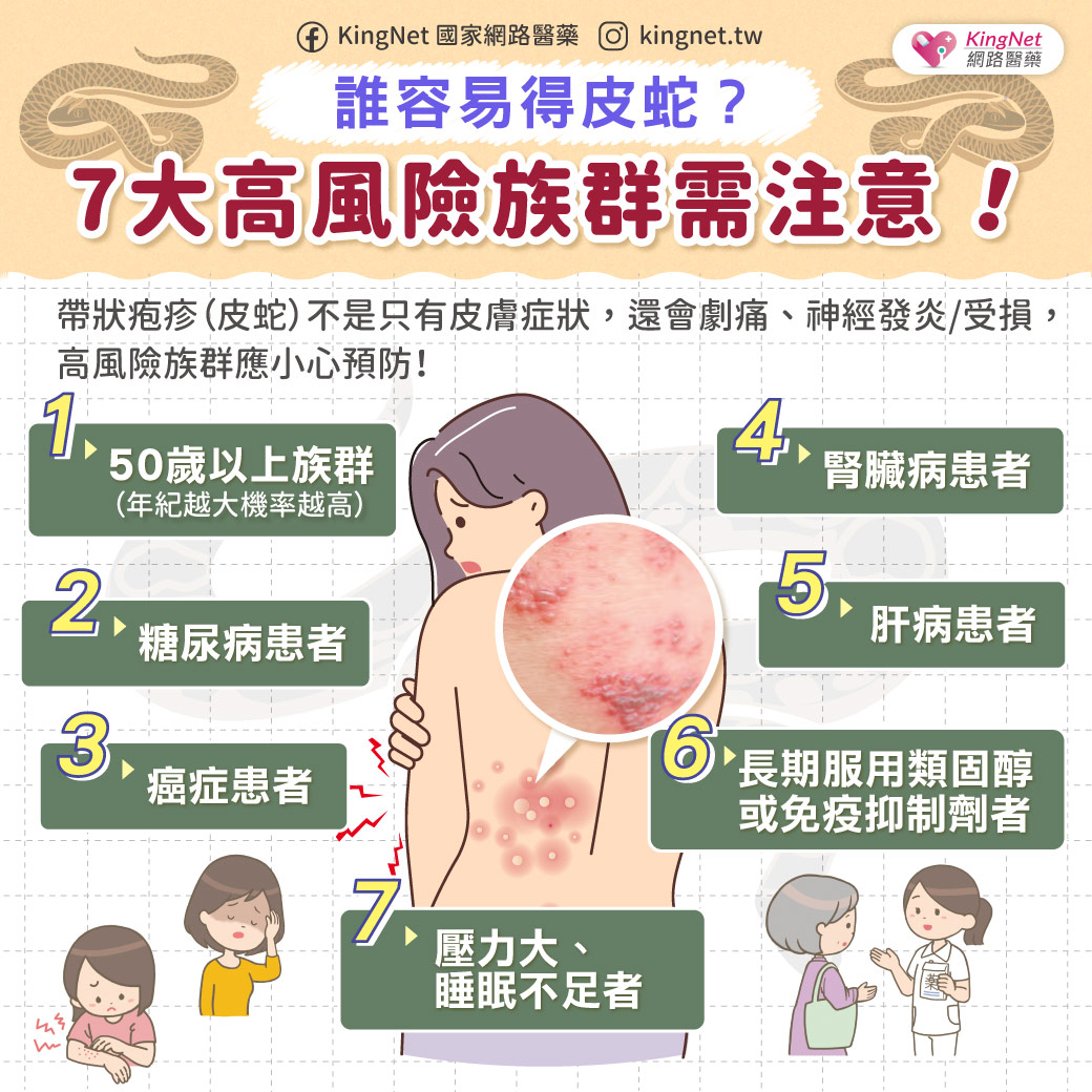「皮蛇不只皮膚症狀！ 7大高風險群易帶狀疱疹發作」健康懶人包