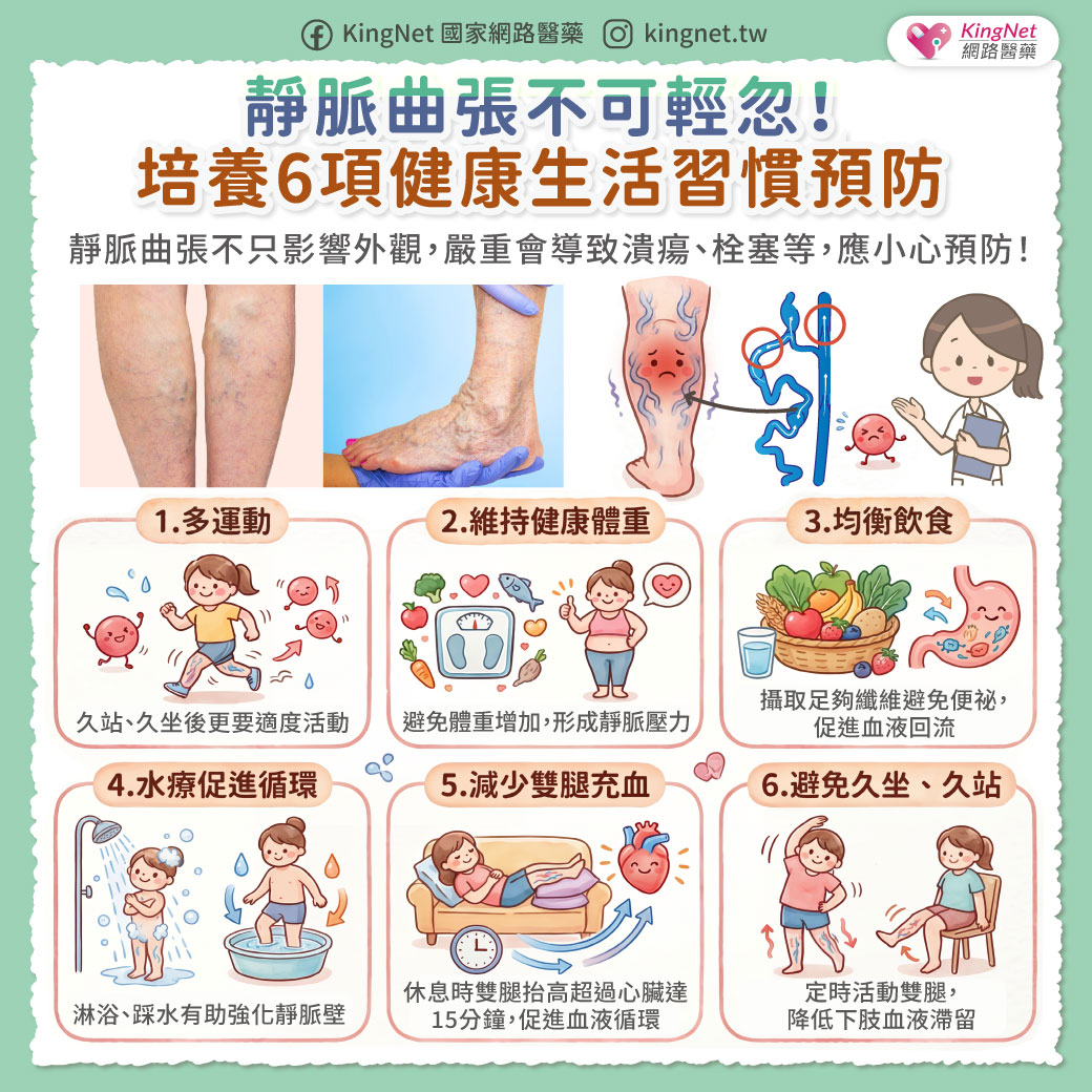 「靜脈曲張不可輕忽！　有哪些方法可以預防？」健康懶人包